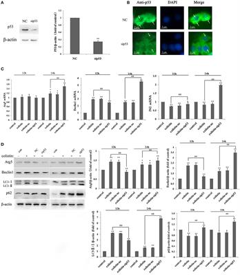 A Dual Role of P53 in Regulating Colistin-Induced Autophagy in PC-12 Cells